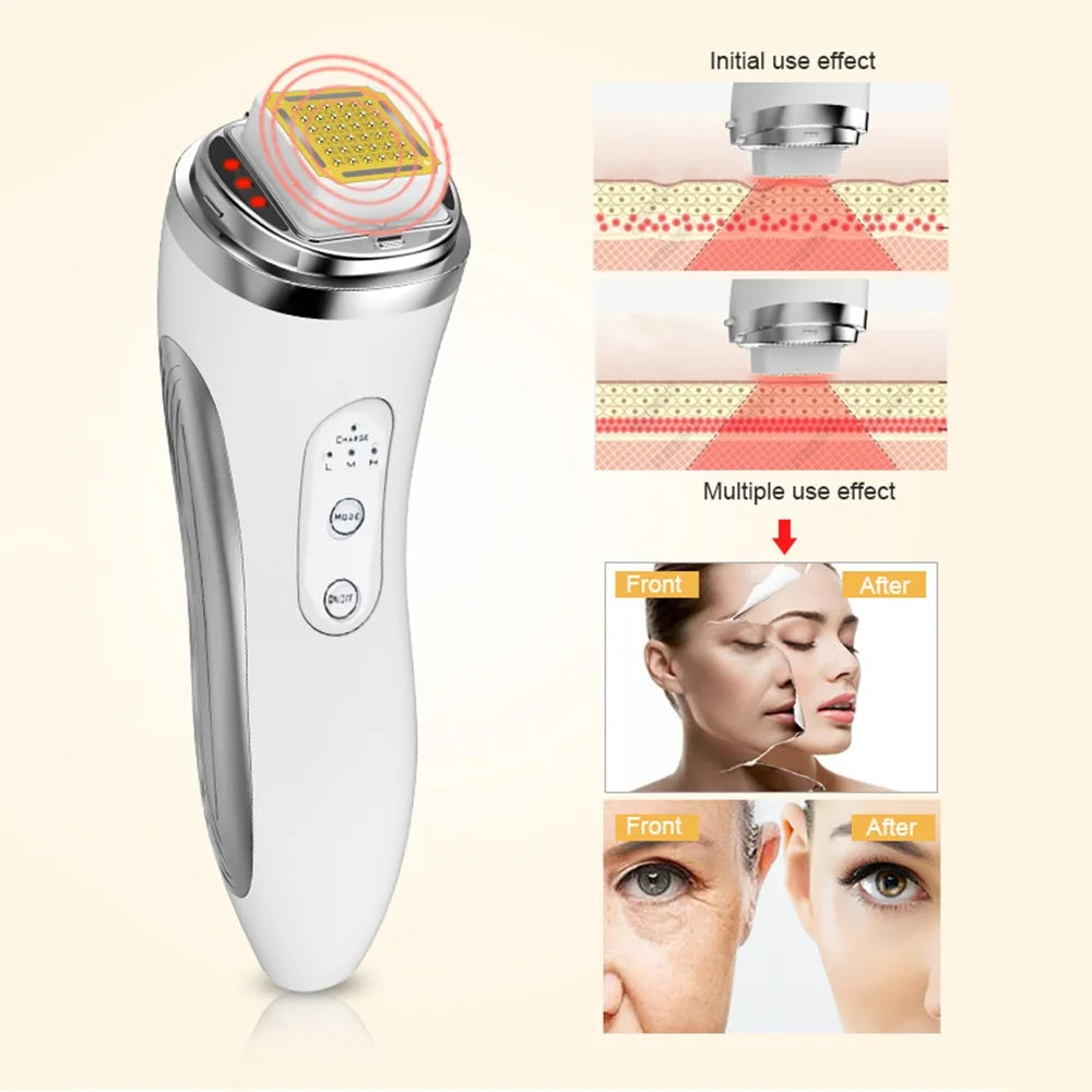 Radio Frequency Facial Lifting Machine Dot Matrix Wrinkle Removal Skin Tightening RF High Frequency Facial Care Device