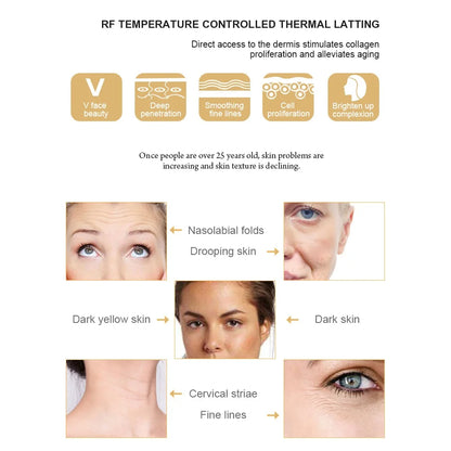 Radio Frequency Facial Lifting Machine Dot Matrix Wrinkle Removal Skin Tightening RF High Frequency Facial Care Device